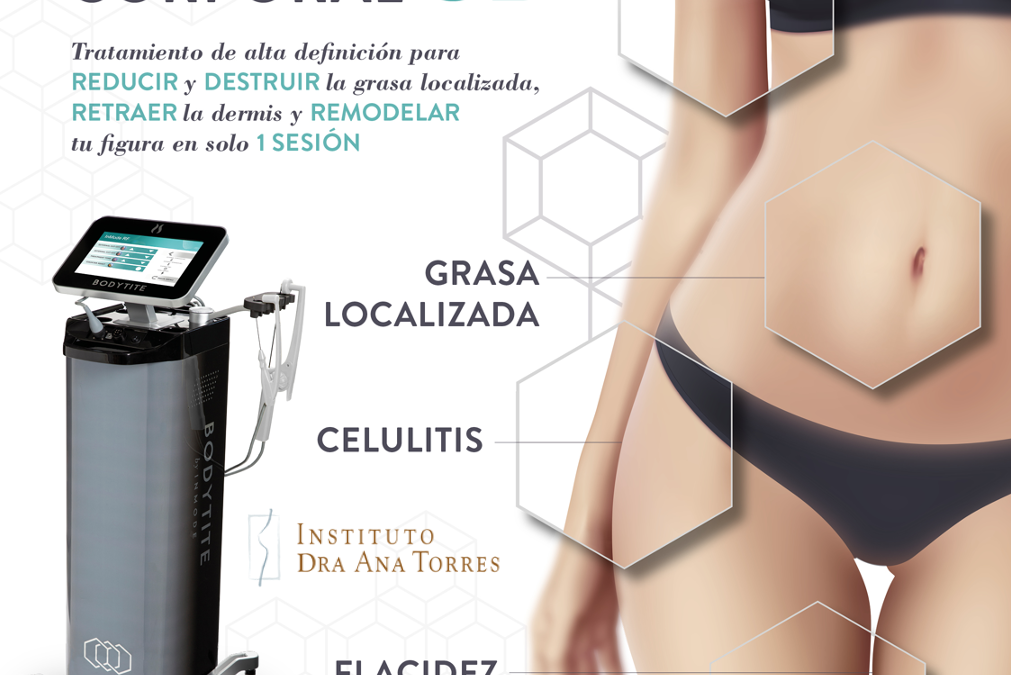 Vídeo reseña de paciente [cat] – abdominoplastia & bodytite en barcelona