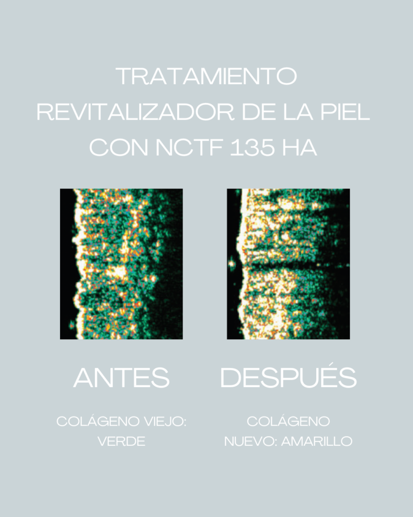 NCTF 135 HA
