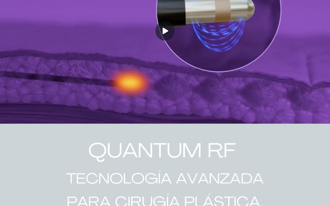 QUANTUMRF EN BARCELONA: TECNOLOGÍA AVANZADA PARA CIRUGÍA PLÁSTICA, REPARADORA Y ESTÉTICA.